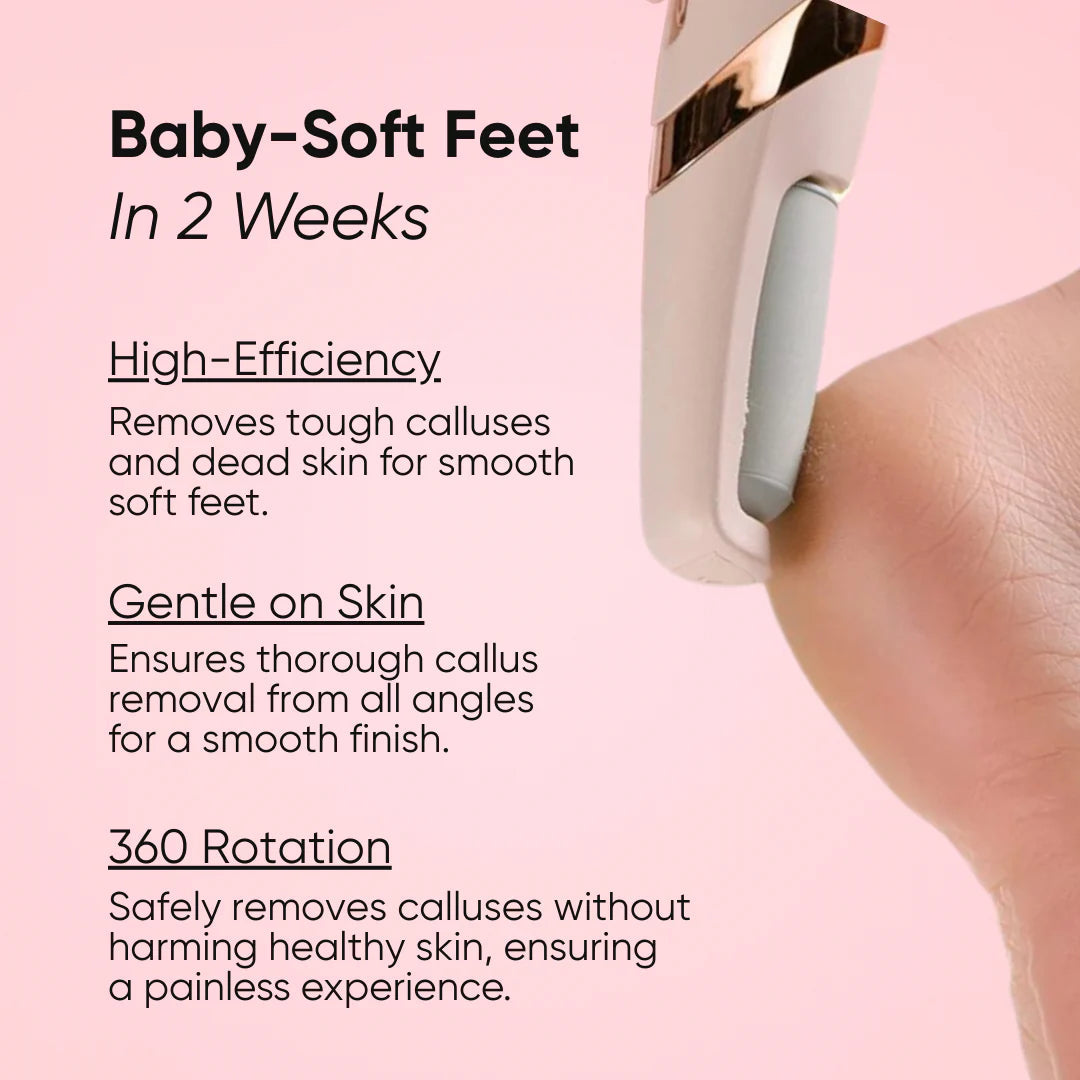 🏆Flash Sale⚡ The Original Callus Remover 2025 New Edition